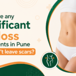fat loss treatments in Pune